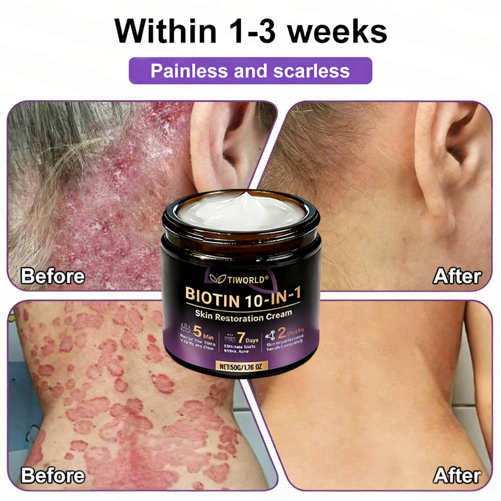Made and Shipped from USA ✨Tiworld® Biotin 10-in-1 Skin Restoration Cream 🍀