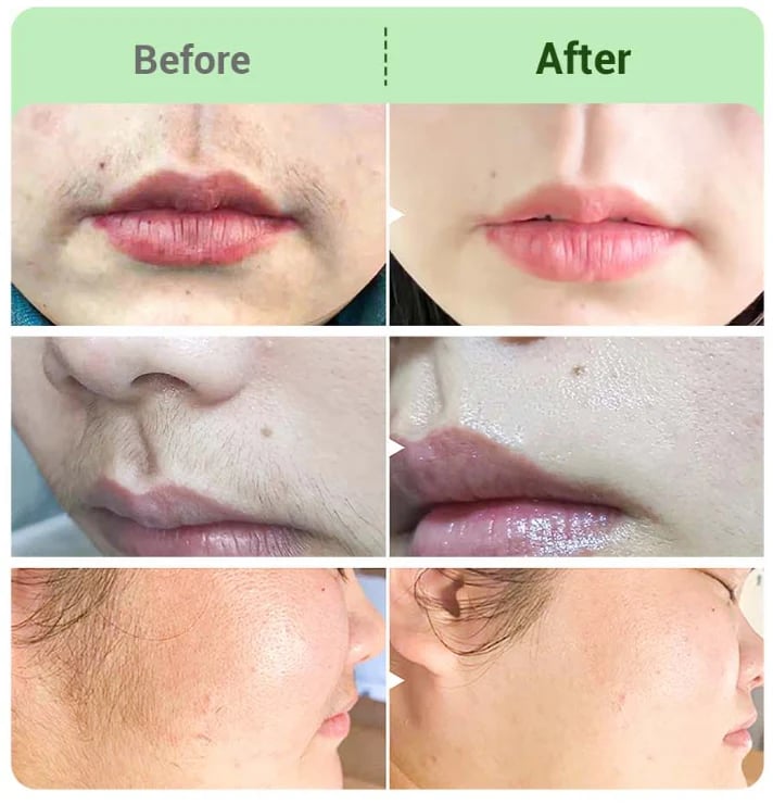 TIWORLD™ Hair Removal Cream for All Women & Men-Discounted Repeat Purchase