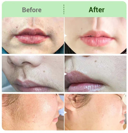 TIWORLD™ Hair Removal Cream for All Women & Men-Discounted Repeat Purchase