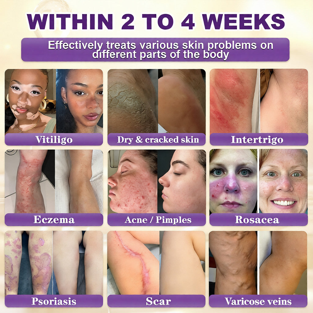 Made and Shipped from USA ✨Tiworld® Biotin 10-in-1 Skin Restoration Cream 🍀