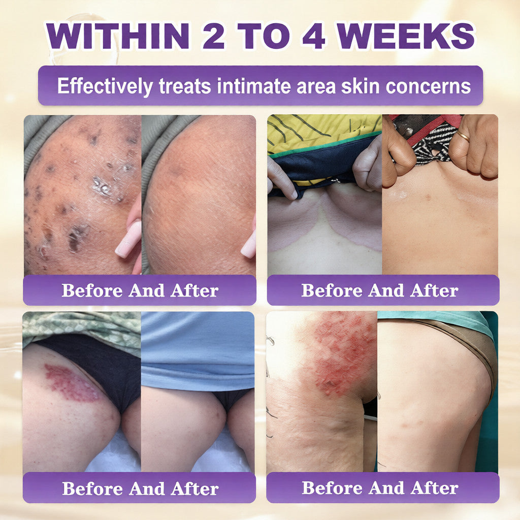 Made and Shipped from USA ✨Tiworld® Biotin 10-in-1 Skin Restoration Cream 🍀